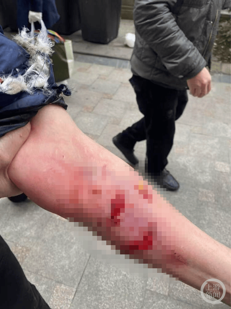 介绍个正网信用网址
_成都一女子小区电梯内被狗咬伤介绍个正网信用网址
，警方称肇事犬只已被控制