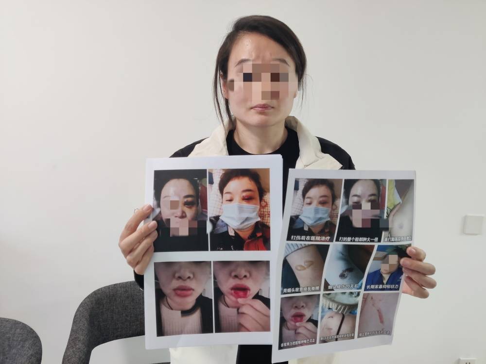 决胜巅峰
_郑州一女子被企业家丈夫家暴最新进展：已要回孩子抚养权