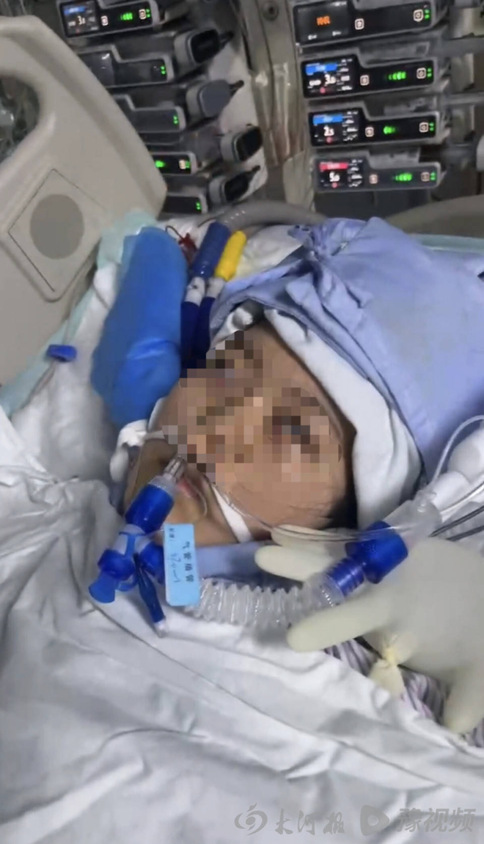 如何代理皇冠信用网
_22岁美甲师手术成功却在复苏室脑死亡如何代理皇冠信用网
，家属称缺氧30分钟监护医生未察觉，医院回应