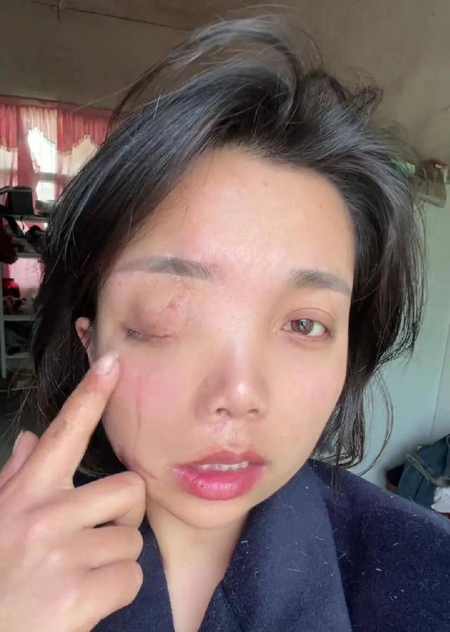新版hga030
_安徽女子左眼失明新版hga030
，办理残疾人证被拒？残联：双眼残疾可办理