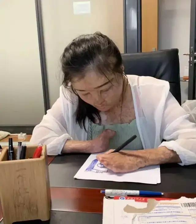 足球平台系统出租
_全身95%烧伤女孩订婚了足球平台系统出租
，与未婚夫同年同月同日生，本人发声：请大家祝福我们吧