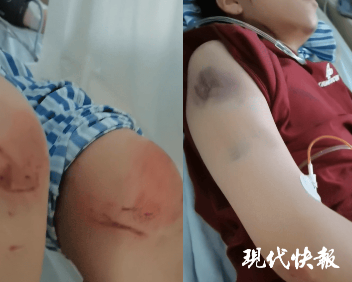 皇冠信用盘在哪里开通
_石家庄被家暴女子驾车逃跑致丈夫身亡皇冠信用盘在哪里开通
，一审以故意杀人罪获刑11年