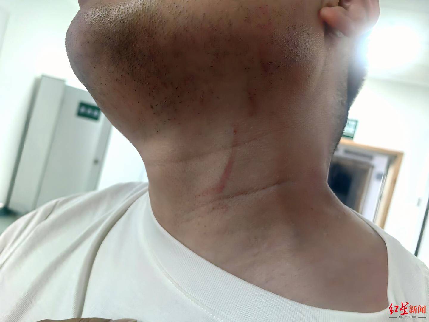 信用平台出租
_武汉男子拍摄违停时被当街殴打信用平台出租
,打人者被罚款500元,被打者称将提起行政复议并起诉