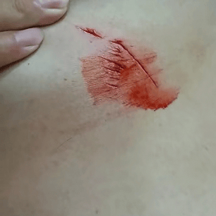 保加利亚U21 vs 直布罗陀U21_罕见!大连钓友钓到一条20斤大鲅鱼保加利亚U21 vs 直布罗陀U21,反被鲅鱼利齿咬伤胸部