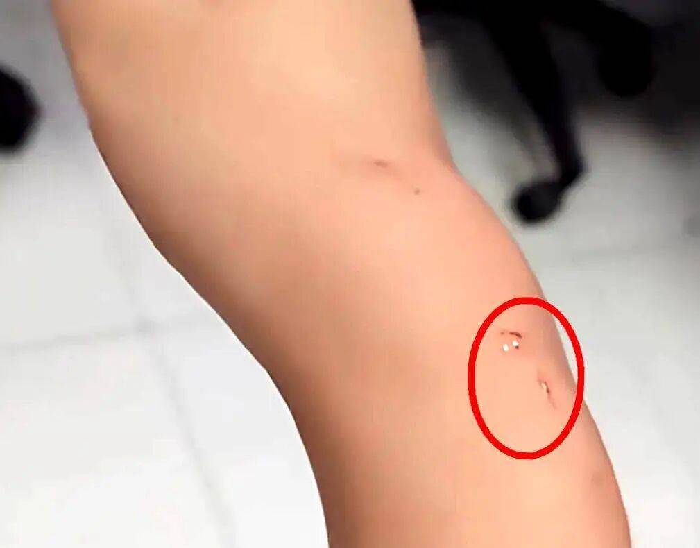 welcome皇冠注册_一旦被咬伤就是Ⅲ级暴露!家中闯入“不速之客”welcome皇冠注册,千万别徒手抓