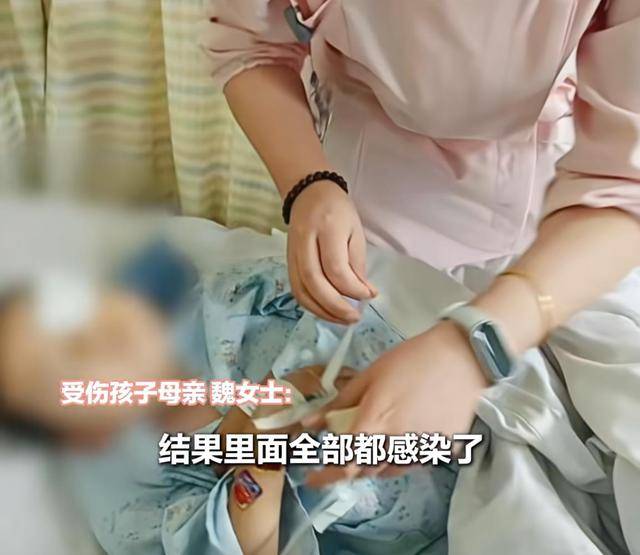 皇冠信用网出租代理_江西一5岁男孩在幼儿园被戳伤致左眼失明皇冠信用网出租代理,家长称老师用猪油涂抹试图消肿