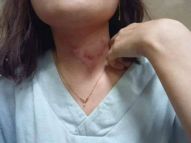 皇冠信用网平台出租
_一男子凌晨听到两声呼救皇冠信用网平台出租
,循声发现一女子在奔驰车外被白衣男勒昏!受害者:是受朋友之托借钱给白衣男,凌晨被骗至偏僻处遭非礼!